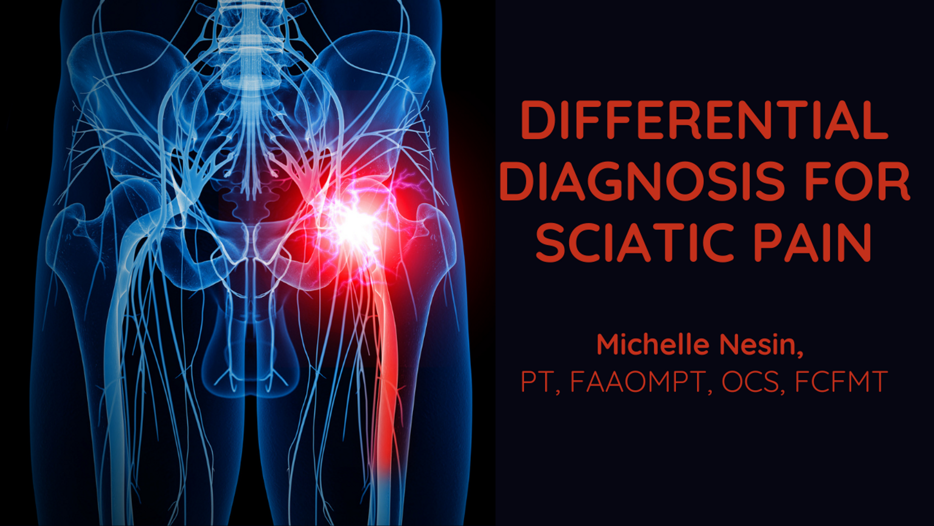 Differential Diagnosis for Sciatic Pain